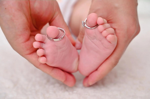 磐石孕妇肝内胆汁淤积症